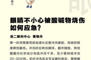 眼部烧伤急救要“早”！掌握正确处理方法至关重要