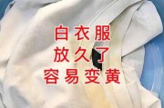 衣服沾到污渍要怎么清理干净：衣服上污渍怎么才能去除