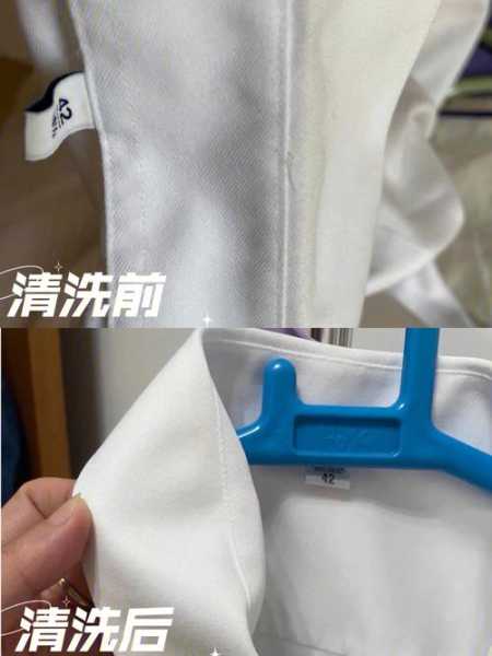 白色衣服发黄该怎么办小妙招：白色衣服发黄该怎么办小妙招视频