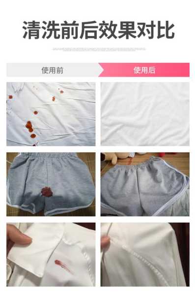 衣服上的血迹怎么弄干净：衣服上的血迹怎么清除掉