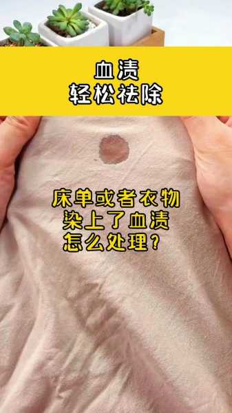 衣服的血迹怎么才能洗掉：衣服的血迹如何洗掉