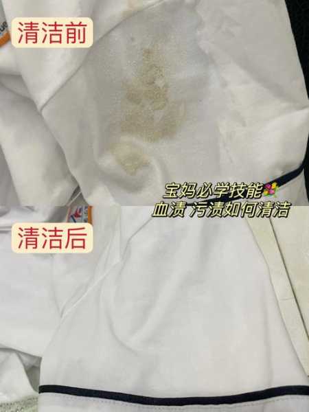 衣服上血迹怎么弄掉：衣服上血迹如何擦掉